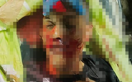 Alias ‘La R4t4’ Asesinado y Alias ‘El Chamo’ Herido en Ataque Sicarial en el Danubio, Comuna de Villa Santana